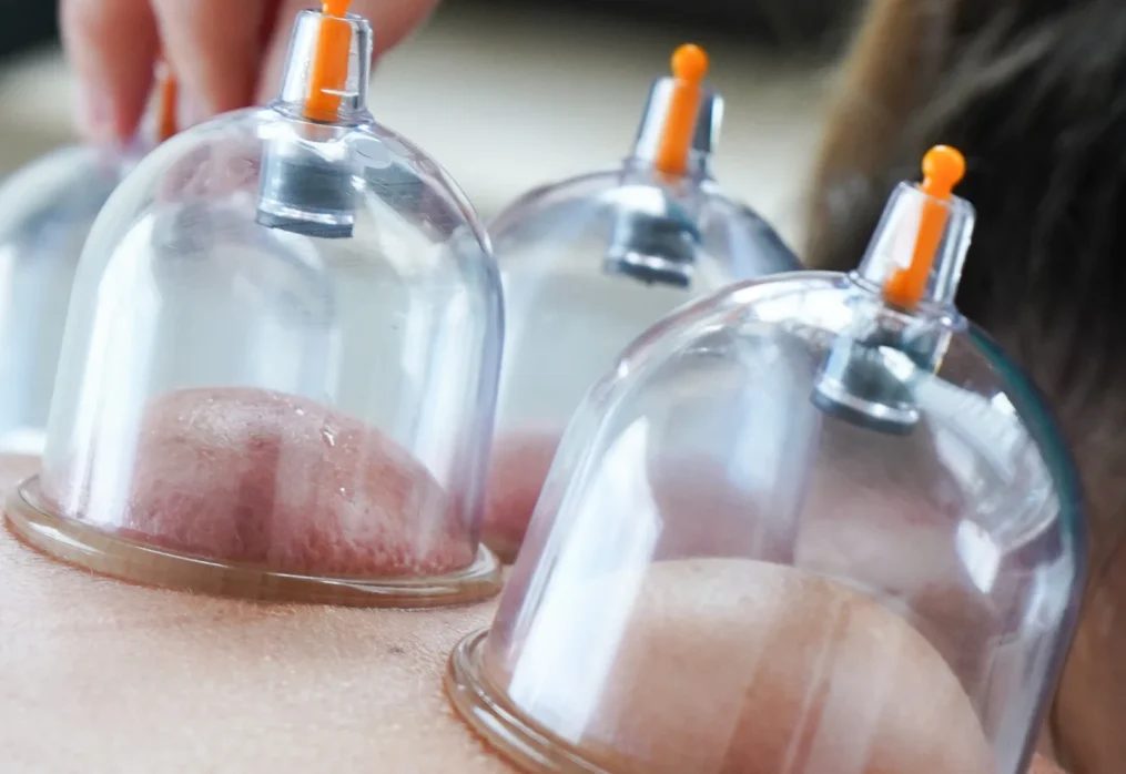 Medicina Tradicional Chinesa e a Saúde da Mulher