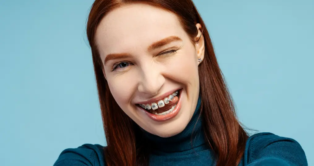 Mulher jovem a sorrir com aparelho dentário em tratamento de ortodontia na clínica Blag em Lisboa