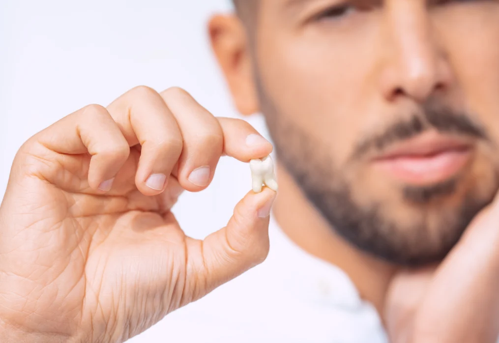 Extração de dente do siso: quando fazer e cuidados após a cirurgia